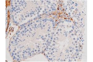 ABIN6267508 at 1/200 staining Mouse testis tissue sections by IHC-P.
