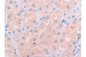 DAB staining on IHC-P; Samples: Human Kidney Tissue (IL3RA anticorps  (AA 19-158))