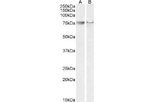 ABIN184672 (0. (PTGS2 anticorps  (C-Term))