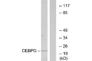 Immunohistochemistry analysis of paraffin-embedded human heart tissue using CEBPG antibody. (CEBPG anticorps)