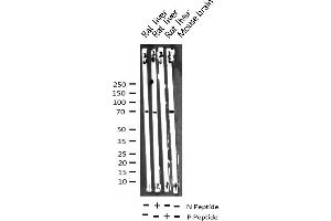Western blot analysis of Phospho-p70 S6 Kinase (Thr421) expression in various lysates