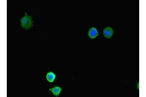 Immunofluorescent analysis of MCF-7 cells using ABIN7158695 at dilution of 1:100 and Alexa Fluor 488-congugated AffiniPure Goat Anti-Rabbit IgG(H+L) (KDM4A anticorps  (AA 127-364))