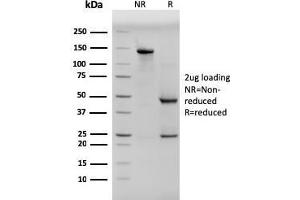 SDS-PAGE Analysis Purified Pan-Cytokeratin Mouse Monoclonal Antibody (PCK/3150). (KRT anticorps)