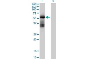 Western Blot analysis of TRIM39 expression in transfected 293T cell line by TRIM39 MaxPab polyclonal antibody. (TRIM39 anticorps  (AA 1-488))