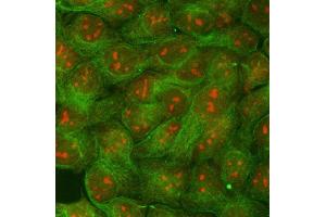 IF analysis of RRP1B and Tubulin beta using anti-RRP1B antibody (ABIN7600561) and anti-Tubulin beta antibody (ABIN7602744). (RRP1B anticorps  (AA 20-727))