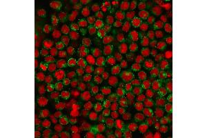 Immunofluorescence staining of Ramos cells using CD27 Mouse Monoclonal Antibody (LPFS2/1611) followed by goat anti-Mouse IgG conjugated to CF488 (green).