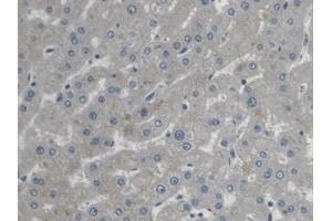 Detection of STIM1 in Human Liver Tissue using Polyclonal Antibody to Stromal Interaction Molecule 1 (STIM1)