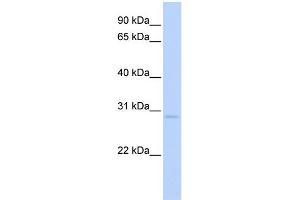 WB Suggested Anti-NR0B2 Antibody Titration:  0. (NR0B2 anticorps  (C-Term))