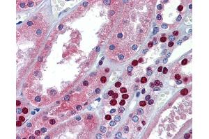 Immunohistochemistry (IHC) image for anti-Multiple PDZ Domain Protein (MPDZ) (Middle Region) antibody (ABIN2775622) (MPDZ anticorps  (Middle Region))