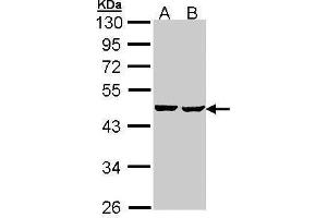WB Image Sample (30 ug of whole cell lysate) A: Hep G2 , B: Molt-4 , 10% SDS PAGE antibody diluted at 1:1000 (SUCLA2 anticorps)