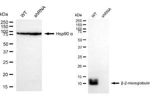 Western blotting analysis using beta 2 Microglobulin antibody (ABIN7797763).