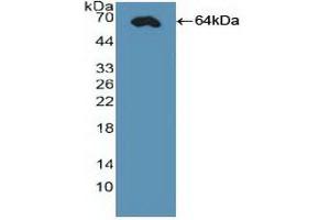 Western blot analysis of recombinant Human CDX2. (CDX2 anticorps  (AA 1-313))