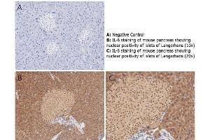 Immunohistochemistry with anti-IL-6 antibody showing nuclear positivity of islets of Langerhans (brown staining) and cytoplasmic staining in mouse pancreas at 10x and 20x (B & C).