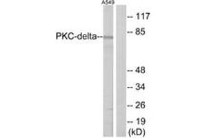 Western blot analysis of extracts from A549 cells, treated with TNF-alpha 20ng/ml 30', using HSF1 (Ab-303) Antibody. (HSF1 anticorps  (AA 270-319))