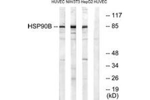 Western blot analysis of extracts from HuvEc/NIH-3T3/HepG2, using HSP90B (Ab-254) Antibody.