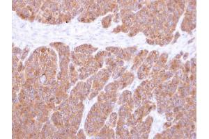 IHC-P Image Immunohistochemical analysis of paraffin-embedded SW480 xenograft, using VTA1, antibody at 1:500 dilution. (VTA1 anticorps  (Center))