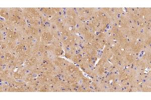 Detection of MOG in Mouse Spinal cord Tissue using Polyclonal Antibody to Myelin Oligodendrocyte Glycoprotein (MOG) (MOG anticorps  (AA 30-149))