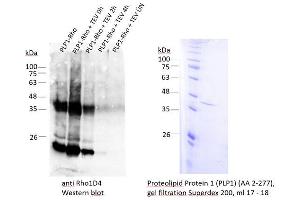 Image no. 3 for Proteolipid Protein 1 (PLP1) (AA 2-277) protein (ABIN3084135) (PLP1 Protein (AA 2-277))