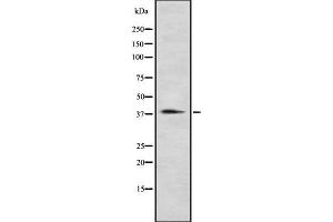 Western blot analysis P2RY12 using Jurkat whole cell lysates. (P2RY12 anticorps)