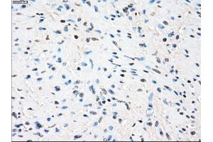 Immunohistochemical staining of paraffin-embedded Ovary tissue using anti-ZFP36 mouse monoclonal antibody.