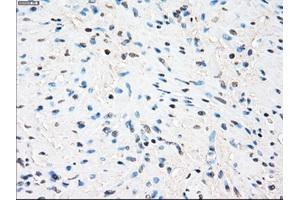 Immunohistochemical staining of paraffin-embedded Ovary tissue using anti-ZFP36 mouse monoclonal antibody. (ZFP36 anticorps)