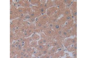 IHC-P analysis of Human Tissue, with DAB staining. (CEACAM1 anticorps  (AA 35-320))