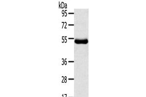 Western Blot analysis of Human thigh malignant fibrous histiocytoma tissue using TMPRSS11D Polyclonal Antibody at dilution of 1/800 (TMPRSS11D anticorps)
