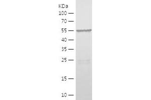 Western Blotting (WB) image for Peroxisomal Biogenesis Factor 5 (PEX5) (AA 94-270) protein (His-IF2DI Tag) (ABIN7124372)