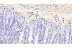 Detection of CTR in Mouse Colon Tissue using Polyclonal Antibody to Calcitonin Receptor (CTR)