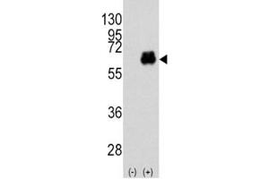Western blot analysis of Myc antibody and 293 cell lysate (2 ug/lane) either nontransfected (Lane 1) or transiently transfected with the MYC gene (2).