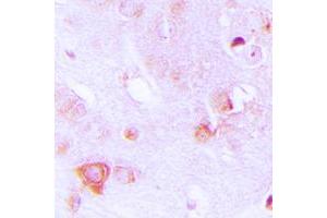 Immunohistochemical analysis of ALDOC staining in human brain formalin fixed paraffin embedded tissue section.