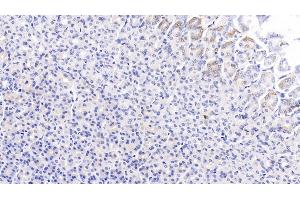 Detection of PCSK9 in Rat Stomach Tissue using Monoclonal Antibody to Proprotein Convertase Subtilisin/Kexin Type 9 (PCSK9)