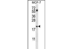 PYCARD Antibody (C-term) (ABIN657783 and ABIN2846757) western blot analysis in MCF-7 cell line lysates (35 μg/lane). (PYCARD anticorps  (C-Term))