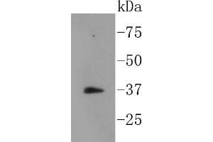 Ags cell lysates probed with IKB alpha (Ser32) (13E7) Monoclonal Antibody  at 1:1000 overnight at 4˚C.