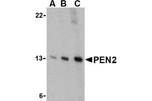 Western Blotting (WB) image for anti-Presenilin Enhancer 2 Homolog (PSENEN) (C-Term) antibody (ABIN1030574) (PEN2 anticorps  (C-Term))