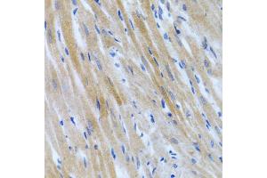 Immunohistochemistry of paraffin-embedded rat heart using BMP3 antibody (ABIN5975705) at dilution of 1/100 (40x lens). (BMP3 anticorps)