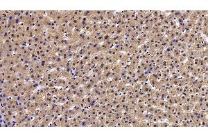 Detection of PON1 in Human Liver Tissue using Polyclonal Antibody to Paraoxonase 1 (PON1)