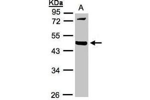 WB Image Sample(30 ug whole cell lysate) A:293T 10% SDS PAGE antibody diluted at 1:1000 (MMP12 anticorps)