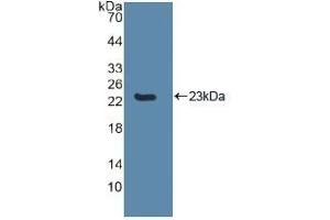 Detection of Recombinant CASP8, Human using Polyclonal Antibody to Caspase 8 (CASP8) (Caspase 8 anticorps  (AA 217-384))