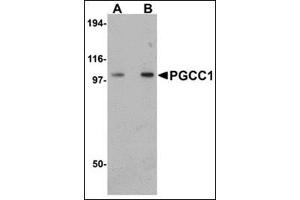 Western blot analysis of PGCC1 in rat thymus tissue lysate with this product at (A) 0. (FAM120B anticorps  (C-Term))