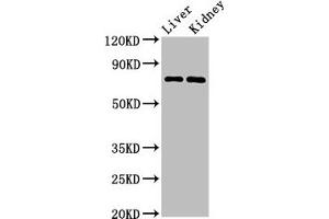 Western Blot Positive WB detected in: Mouse liver tissue, Mouse kidney tissue All lanes: PRDM5 antibody at 3 μg/mL Secondary Goat polyclonal to rabbit IgG at 1/50000 dilution Predicted band size: 74, 70, 13, 59 kDa Observed band size: 74 kDa (PRDM5 anticorps  (AA 29-111))