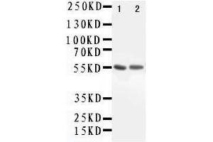 Anti-ALDH1A1 antibody, Western blotting Lane 1: Rat Lung Tissue Lysate Lane 2: COLO320 Cell Lysate