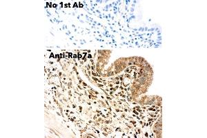 Immunohistochemistry (IHC) image for anti-RAB7A, Member RAS Oncogene Family (RAB7A) (C-Term) antibody (ABIN6254195) (RAB7A anticorps  (C-Term))