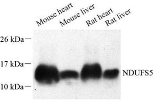 Western blot analysis of NDUFS5 (ABIN7074767) at dilution of 1: 500 (NDUFS5 anticorps)