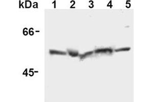 Western Blotting (WB) image for anti-Caspase 12 (Gene/pseudogene) (CASP12) (AA 95-318), (N-Term) antibody (ABIN567796) (Caspase 12 anticorps  (N-Term))