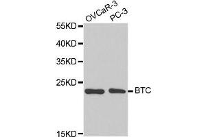 Western blot analysis of extracts of various cell lines, using BTC antibody. (Betacellulin anticorps  (AA 32-178))