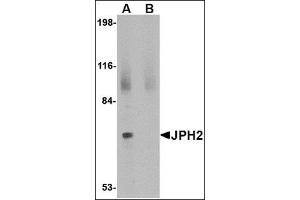 Western blot analysis of JPH2 in 293 cell lysate with this product at 2 μg/ml in (A) the absence and (B) the presence of blocking peptide. (Junctophilin 2 anticorps  (C-Term))
