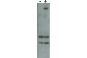 RK8 (LRRK2) Antibody  f detects over-expressed human LRRK2 protein. (LRRK2 anticorps  (AA 878-909))
