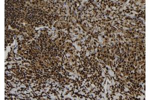 ABIN6277017 at 1/100 staining Human spleen tissue by IHC-P.