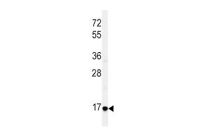 Western blot analysis of EREG Antibody (C-term) (ABIN650993 and ABIN2840027) in HepG2 cell line lysates (35 μg/lane).